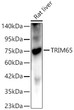 Western blot analysis of lysates from Rat liver, using TRIM65 Rabbit pAb (STJ11106123) at 1:1000 dilution. <br/>Secondary antibody: HRP-conjugated Goat anti-Rabbit IgG (H+L) (STJS000856) at 1:10000 dilution. <br/>Lysates/proteins: 25 Mu g per lane. <br/>Blocking buffer: 3% nonfat dry milk in TBST. <br/>Detection: ECL Basic Kit <br/>Exposure time: 180s.