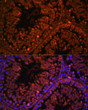 Immunofluorescence analysis of paraffin-embedded rat testis using ART3 Rabbit pAb (STJ11106575) at dilution of 1:100. Secondary antibody: Cy3-conjugated Goat anti-Rabbit IgG (H+L) (STJS001166) at 1:500 dilution. Blue: DAPI for nuclear staining.