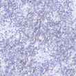 Immunohistochemistry analysis of paraffin-embedded Human T-cell malignant lymphoma using PD-1/CD279 Mouse mAb (STJ11106599) at dilution of 1:50 (40x lens). High pressure antigen retrieval performed with 0. 01M Citrate Bufferr (pH 6. 0) prior to immunohistochemistry staining.