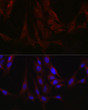 Immunofluorescence analysis of C6 cells using Fam221a Rabbit pAb (STJ11106613) at dilution of 1:100 (40x lens). Secondary antibody: Cy3-conjugated Goat anti-Rabbit IgG (H+L) (STJS001166) at 1:500 dilution. Blue: DAPI for nuclear staining.