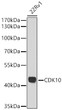 Western blot analysis of lysates from 22Rv1 cells using CDK10 Rabbit pAb (STJ11106817) at1:1000 dilution. <br>Secondary antibody: HRP Goat Anti-Rabbit IgG (H+L) (STJS000856) at 1:10000 dilution. <br>Lysates/proteins: 25  Mu g per lane. <br>Blocking buffer: 3% nonfat dry milk in TBST. <br>Detection: ECL Basic Kit <br>Exposure time: 90s. Western blot analysis of lysates from 22Rv1 cells using CDK10 Rabbit pAb (STJ11106817) at1:1000 dilution. <br>Secondary antibody: HRP Goat Anti-Rabbit IgG (H+L) (STJS000856) at 1:10000 dilution. <br>Lysates/proteins: 25  Mu g per lane. <br>Blocking buffer: 3% nonfat dry milk in TBST. <br>Detection: ECL Basic Kit <br>Exposure time: 90s.