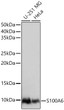 Western blot analysis of various lysates using S100A6 Rabbit pAb (STJ11106830) at 1:1000 dilution. <br> Secondary antibody: HRP-conjugated Goat anti-Rabbit IgG (H+L) (STJS000856) at 1:10000 dilution. <br> Lysates/ proteins: 25 Mu g per lane. <br> Blocking buffer: 3 % nonfat dry milk in TBST. <br> Detection: ECL Basic Kit <br> Exposure time: 1s.