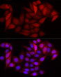 Immunofluorescence analysis of HeLa cells using S100A6 Rabbit pAb (STJ11106830) at dilution of 1:100 (40x lens). Secondary antibody: Cy3-conjugated Goat anti-Rabbit IgG (H+L) (STJS001166) at 1:500 dilution. Blue: DAPI for nuclear staining.