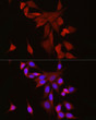 Immunofluorescence analysis of NIH/3T3 cells using S100A6 Rabbit pAb (STJ11106830) at dilution of 1:100 (40x lens). Secondary antibody: Cy3-conjugated Goat anti-Rabbit IgG (H+L) (STJS001166) at 1:500 dilution. Blue: DAPI for nuclear staining.