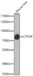 Western blot analysis of lysates from Mouse liver using CYPOR Rabbit pAb (STJ11106836) at1:1000 dilution. <br>Secondary antibody:HRP Goat Anti-Rabbit IgG (H+L) (STJS000856) at 1:10000 dilution. <br>Lysates/proteins: 25  Mu g per lane. <br>Blocking buffer: 3% nonfat dry milk in TBST. <br>Detection:ECL Basic Kit <br>Exposuretime:1s.