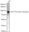 Western blot analysis of lysates from HeLa cells, using CD71/Transferrin Receptor Rabbit mAb (STJ11106847) at1:80000 dilution. <br/>Secondary antibody: HRP-conjugated Goat anti-Rabbit IgG (H+L) (STJS000856) at 1:10000 dilution. <br/>Lysates/proteins: 25 Mu g per lane. <br/>Blocking buffer: 3% nonfat dry milk in TBST. <br/>Detection: ECL Basic Kit <br/>Exposure time: 5s.