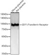 Immunohistochemistry analysis of paraffin-embedded Human lung using CD71/Transferrin Receptor Rabbit mAb (STJ11106847) at dilution of 1:200 (40x lens). High pressure antigen retrieval performed with 0. 01M Citrate Bufferr (pH 6. 0) prior to immunohistochemistry staining.