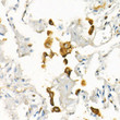 Confocal imaging of HeLa cells using CD71/Transferrin Receptor Rabbit mAb (STJ11106847, dilution 1:200) (Red). The cells were counterstained with CD44 Rabbit mAb (STJ254679, dilution 1:200) (Green). DAPI was used for nuclear staining (blue). Objective: 60x.