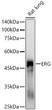 Western blot analysis of lysates from Rat lung, using ERG Rabbit mAb (STJ11106848) at1:2000 dilution. <br/>Secondary antibody: HRP-conjugated Goat anti-Rabbit IgG (H+L) (STJS000856) at 1:10000 dilution. <br/>Lysates/proteins: 25 Mu g per lane. <br/>Blocking buffer: 3% nonfat dry milk in TBST. <br/>Detection: ECL Basic Kit <br/>Exposure time: 180s. Western blot analysis of lysates from Rat lung, using ERG Rabbit mAb (STJ11106848) at1:2000 dilution. <br/>Secondary antibody: HRP-conjugated Goat anti-Rabbit IgG (H+L) (STJS000856) at 1:10000 dilution. <br/>Lysates/proteins: 25 Mu g per lane. <br/>Blocking buffer: 3% nonfat dry milk in TBST. <br/>Detection: ECL Basic Kit <br/>Exposure time: 180s.