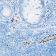 Immunohistochemistry analysis of paraffin-embedded Human appendix using ERG Rabbit mAb (STJ11106848) at dilution of 1:100 (40x lens). High pressure antigen retrieval performed with 0. 01M Tris/EDTA Buffer (pH 9. 0) prior to immunohistochemistry staining. Immunohistochemistry analysis of paraffin-embedded Human appendix using ERG Rabbit mAb (STJ11106848) at dilution of 1:100 (40x lens). High pressure antigen retrieval performed with 0. 01M Tris/EDTA Buffer (pH 9. 0) prior to immunohistochemistry staining.