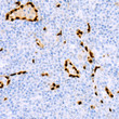 Immunohistochemistry analysis of paraffin-embedded Human tonsil using ERG Rabbit mAb (STJ11106848) at dilution of 1:100 (40x lens). High pressure antigen retrieval performed with 0. 01M Tris/EDTA Buffer (pH 9. 0) prior to immunohistochemistry staining. Immunohistochemistry analysis of paraffin-embedded Human tonsil using ERG Rabbit mAb (STJ11106848) at dilution of 1:100 (40x lens). High pressure antigen retrieval performed with 0. 01M Tris/EDTA Buffer (pH 9. 0) prior to immunohistochemistry staining.