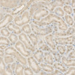 Immunohistochemistry analysis of paraffin-embedded Mouse kidney using Cleaved Caspase-9 P37 Rabbit pAb (STJ11106883) at dilution of 1:50 (40x lens). High pressure antigen retrieval performed with 0. 01M Citrate Bufferr (pH 6. 0) prior to immunohistochemistry staining.