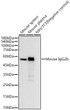 Western blot analysis of various lysates, using Rabbit Anti-Mouse IgG2b (STJ11106887) at 1:8000 dilution. <br/>Secondary antibody: HRP-conjugated Goat anti-Rabbit IgG (H+L) (STJS000856) at 1:10000 dilution. <br/>Lysates/proteins: 25 Mu g per lane. <br/>Blocking buffer: 3% nonfat dry milk in TBST. <br/>Detection: ECL Basic Kit <br/>Exposure time: 60s.