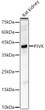 Western blot analysis of lysates from Rat kidney, using PJVK Rabbit pAb (STJ11106888) at 1:1000 dilution. <br/>Secondary antibody: HRP-conjugated Goat anti-Rabbit IgG (H+L) (STJS000856) at 1:10000 dilution. <br/>Lysates/proteins: 25 Mu g per lane. <br/>Blocking buffer: 3% nonfat dry milk in TBST. <br/>Detection: ECL Basic Kit <br/>Exposure time: 40s.
