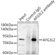 Western blot analysis of various lysates, using AFG3L2 Rabbit pAb (STJ11106949) at 1:1000 dilution. <br/>Secondary antibody: HRP-conjugated Goat anti-Rabbit IgG (H+L) (STJS000856) at 1:10000 dilution. <br/>Lysates/proteins: 25 Mu g per lane. <br/>Blocking buffer: 3% nonfat dry milk in TBST. <br/>Detection: ECL Basic Kit <br/>Exposure time: 60s.