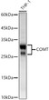 Western blot analysis of lysates from THP-1 cells using [KD Validated] COMT Rabbit pAb (STJ11106950) at 1:700 dilution. <br/>Secondary antibody:HRP Goat Anti-Rabbit IgG (H+L) ( STJS000856) at 1:10000 dilution. <br/>Lysates/proteins: 25  Mu g per lane. <br/>Blocking buffer: 3% nonfat dry milk in TBST. <br/>Detection: ECL Basic Kit <br/>Exposure time: 10s.