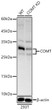 Western blot analysis of lysates from wild type (WT) and COMT knockdown (KD)  293T cells using [KD Validated] COMT Rabbit pAb (STJ11106950) at1:700 dilution. <br>Secondary antibody:HRP Goat Anti-Rabbit IgG (H+L) (STJS000856) at 1:10000 dilution. Lysates/proteins: 25  Mu g per lane. <br>Blocking buffer: 3% nonfat dry milk in TBST. <br>Detection:ECL Basic Kit <br>Exposuretime: 10s.