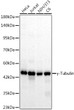 Western blot analysis of various lysates, using Gamma-Tubulin Rabbit mAb (STJ11106968) at1:1000 dilution. <br/>Secondary antibody: HRP-conjugated Goat anti-Rabbit IgG (H+L) (STJS000856) at 1:10000 dilution. <br/>Lysates/proteins: 25 Mu g per lane. <br/>Blocking buffer: 3% nonfat dry milk in TBST. <br/>Detection: ECL Basic Kit <br/>Exposure time: 20s.