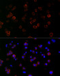 Immunofluorescence analysis of Raji cells using ICAM-1/CD54 Rabbit mAb (STJ11106969) at dilution of 1:300 (40x lens). Secondary antibody: Cy3-conjugated Goat anti-Rabbit IgG (H+L) (STJS001166) at 1:500 dilution. Blue: DAPI for nuclear staining.