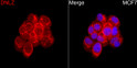 Immunofluorescence analysis of MCF7 cells using DNLZ Rabbit pAb (STJ11106997) ata dilution of 1:200 (40x lens). Secondary antibody:Cy3 Goat Anti-Rabbit IgG (H+L) (STJS001166) at 1:500 dilution.  Blue: DAPI for nuclear staining.