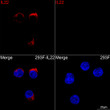 Confocal imaging of 293F-IL22 and 293F cells using IL22 Rabbit mAb (STJ11107003, dilution 1:200) (Red). DAPI was used for nuclear staining (blue). Objective: 100x.