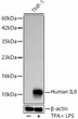 Western blot analysis of lysates from THP-1 cells using IL8 Rabbit mAb (STJ11107026) at 1:1000 dilution. THP-1 cells were treated by PMA/TPA (80 nM) at 37C for overnight and LPS (1 Mu g/ml) at 37C for 6 hours. <br>Secondary antibody: HRP-conjugated Goat anti-Rabbit IgG (H+L) (STJS000856) at 1:10000 dilution. <br>Lysates/proteins: 25 Mu g per lane. <br>Blocking buffer: 3% nonfat dry milk in TBST. <br>Detection: ECL Basic Kit <br>Exposure time: 90s.