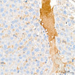 Immunohistochemistry analysis of APOB in paraffin-embedded Rat liver tissue using APOB Rabbit pAb  (STJ11107041) at a dilution of 1:200 (40x lens).  High pressure antigen retrieval was performed with 0. 01 M citrate buffer (pH 6. 0) prior to immunohistochemistry staining.