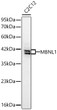 Western blot analysis of lysates from C2C12 cells using MBNL1 Rabbit pAb (STJ11107046) at 1:1000 dilution incubated overnight at 4C. <br>Secondary antibody: HRP-conjugated Goat anti-Rabbit IgG (H+L) (STJS000856) at 1:10000 dilution. <br>Lysates/proteins: 25 Mu g per lane. <br>Blocking buffer: 3% nonfat dry milk in TBST. <br>Detection: ECL Basic Kit <br>Exposure time: 90s.
