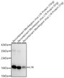 Western blot analysis of Recombinant Monkeypox virus L1R Protein (STJP001528) using L1R Rabbit pAb (STJ11107073) at 1:1000 dilution. <br>Secondary antibody: HRP-conjugated Goat anti-Rabbit IgG (H+L) (STJS000856) at 1:10000 dilution. <br>Lysates/proteins: 10ng/5ng/1ng per lane. <br>Blocking buffer: 3% nonfat dry milk in TBST. <br>Detection: ECL Basic Kit <br>Exposure time: 1s. Western blot analysis of Recombinant Monkeypox virus L1R Protein (STJP001528) using L1R Rabbit pAb (STJ11107073) at 1:1000 dilution. <br>Secondary antibody: HRP-conjugated Goat anti-Rabbit IgG (H+L) (STJS000856) at 1:10000 dilution. <br>Lysates/proteins: 10ng/5ng/1ng per lane. <br>Blocking buffer: 3% nonfat dry milk in TBST. <br>Detection: ECL Basic Kit <br>Exposure time: 1s.