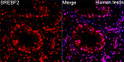 Immunofluorescence analysis of Human testis tissue using SREBF2 Rabbit pAb (STJ11107085) at a dilution of 1:100 (40x lens). Secondary antibody: Cy3-conjugated Goat anti-Rabbit IgG (H+L) (STJS001166) at 1:500 dilution. Blue: DAPI for nuclear staining. High pressure antigen retrieval performed with 0. 01M Citrate Buffer (pH 6. 0) prior to IF staining.