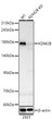 Western blot analysis of lysates from 293T cells using [KD Validated] KDM2B Rabbit pAb (STJ11107090) at 1:1000 dilution incubated overnight at 4°C. <br>Secondary antibody: HRP-conjugated Goat anti-Rabbit IgG (H+L) (STJS000856) at 1:10000 dilution. <br>Lysates/proteins: 25 Mu g per lane. <br>Blocking buffer: 3% nonfat dry milk in TBST. <br>Detection: ECL Basic Kit (