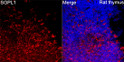 Immunofluorescence analysis of Rat thymus tissue using SGPL1 Rabbit pAb (STJ11107092) at a dilution of 1:100 (40x lens). Secondary antibody: Cy3 Goat Anti-Rabbit IgG (H+L) (STJS001166) at 1:500 dilution. Blue: DAPI for nuclear staining. High pressure antigen retrieval performed with 0. 01M Citrate Buffer (pH 6. 0) prior to IF staining.