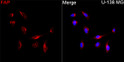 Immunofluorescence analysis of U-138 MG cells using FAP Rabbit pAb (STJ11107106) at a dilution of 1:100 (40x lens). Secondary antibody: Cy3-conjugated Goat anti-Rabbit IgG (H+L) (STJS001166) at 1:500 dilution. Blue: DAPI for nuclear staining.