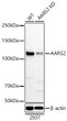 Western blot analysis of lysates from wild type (WT) and AARS2 knockdown (KD) 293T cells using [KD Validated] AARS2 Rabbit pAb (STJ11107130) at 1:1000 dilution incubated overnight at 4C. <br>Secondary antibody: HRP-conjugated Goat anti-Rabbit IgG (H+L) (STJS000856) at 1:10000 dilution. <br>Lysates/proteins: 25 Mu g per lane. <br>Blocking buffer: 3% nonfat dry milk in TBST. <br>Detection: ECL Basic Kit <br>Exposure time: 90s.