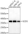 Western blot analysis of various lysates using SCD5 Rabbit pAb (STJ11107249) at 1:3000 dilution incubated overnight at 4C. <br>Secondary antibody: HRP-conjugated Goat anti-Rabbit IgG (H+L) (STJS000856) at 1:10000 dilution. <br>Lysates/proteins: 25 Mu g per lane. <br>Blocking buffer: 3% nonfat dry milk in TBST. <br>Detection: ECL Basic Kit <br>Exposure time: 30s.