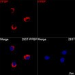Confocal imaging of 293T cells transfected with PPBP using PPBP Rabbit mAb (STJ11107354, dilution 1:200) followed by a further incubation with Cy3 Goat Anti-Rabbit IgG (H+L) (STJS001166, dilution 1:500) (Red). DAPI was used for nuclear staining (Blue). Objective: 100x.