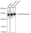 Western blot analysis of various lysates using CD304/Neuropilin-1 Rabbit mAb (STJ11107373) at 1:1000 dilution incubated overnight at 4C. <br>Secondary antibody: HRP-conjugated Goat anti-Rabbit IgG (H+L) (STJS000856) at 1:10000 dilution. <br>Lysates/proteins: 25 Mu g per lane. <br>Blocking buffer: 3% nonfat dry milk in TBST. <br>Detection: ECL Basic Kit <br>Exposure time: 90s.