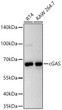 Western blot analysis of various lysates using cGAS Mouse mAb (STJ11107376) at 1:1000 dilution incubated overnight at 4C. <br>Secondary antibody: HRP-conjugated Goat anti-Mouse IgG (H+L) (STJS000854) at 1:10000 dilution. <br>Lysates/proteins: 25 Mu g per lane. <br>Blocking buffer: 3% nonfat dry milk in TBST. <br>Detection: ECL Basic Kit <br>Exposure time: 20s.
