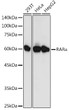 Western blot analysis of various lysates using RAR Alpha Rabbit pAb (STJ11107459) at 1:1000 dilution. <br/>Secondary antibody: HRP-conjugated Goat anti-Rabbit IgG (H+L) (STJS000856) at 1:10000 dilution. <br/>Lysates/proteins: 25 Mu g per lane. <br/>Blocking buffer: 3% nonfat dry milk in TBST. <br/>Detection: ECL Basic Kit <br/>Exposure time: 30s.