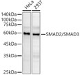 Western blot analysis of various lysates using SMAD2/SMAD3 Rabbit pAb (STJ11107460) at 1:700 dilution. <br/>Secondary antibody: HRP-conjugated Goat anti-Rabbit IgG (H+L) (STJS000856) at 1:10000 dilution. <br/>Lysates/proteins: 25 Mu g per lane. <br/>Blocking buffer: 3% nonfat dry milk in TBST. <br/>Detection: ECL Basic Kit <br/>Exposure time: 90s.