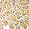 Immunohistochemistry analysis of paraffin-embedded Human gastric using SMAD2/SMAD3 Rabbit pAb (STJ11107460) at dilution of 1:100 (40x lens). Microwave antigen retrieval performed with 0. 01M PBS Buffer (pH 7. 2) prior to immunohistochemistry staining.