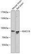 Western blot analysis of various lysates using RNF219 Rabbit pAb (STJ11107510) at 1:1000 dilution. <br/>Secondary antibody: HRP-conjugated Goat anti-Rabbit IgG (H+L) (STJS000856) at 1:10000 dilution. <br/>Lysates/proteins: 25 Mu g per lane. <br/>Blocking buffer: 3% nonfat dry milk in TBST. <br/>Detection: ECL Basic Kit <br/>Exposure time: 90s.