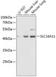 Western blot analysis of various lysates using SLC16A11 Rabbit pAb (STJ11107525) at 1:1000 dilution. <br/>Secondary antibody: HRP-conjugated Goat anti-Rabbit IgG (H+L) (STJS000856) at 1:10000 dilution. <br/>Lysates/proteins: 25 Mu g per lane. <br/>Blocking buffer: 3% nonfat dry milk in TBST. <br/>Detection: ECL Enhanced Kit <br/>Exposure time: 30s.