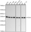 Western blot analysis of various lysates using PCNA Mouse mAb (STJ11107563) at 1:5000 dilution incubated overnight at 4C. <br>Secondary antibody: HRP-conjugated Goat anti-Mouse IgG (H+L) (STJS000854) at 1:10000 dilution. <br>Lysates/proteins: 25 Mu g per lane. <br>Blocking buffer: 3% nonfat dry milk in TBST. <br>Detection: ECL Basic Kit <br>Exposure time: 10s.