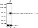 Western blot analysis of lysates from 293T cells using Phospho-AMPK Alpha 1-T183/AMPK Alpha 2-T172 Rabbit pAb (STJ11107614) at 1:1000 dilution incubated overnight at 4 °C. 293T cells were treated by Calyculin A (100 nM) at 37 °C for 30 minutes after serum-starvation overnight. <br/> Secondary antibody: HRP-conjugated Goat anti-Rabbit IgG (H+L) (STJS000856) at 1:10000 dilution. <br/>Lysates/proteins: 30 Mu g per lane. <br/> Blocking buffer: 3 % nonfat dry milk in TBST. <br/> Detection: ECL Basic Kit <br/> Exposure time: 90s.