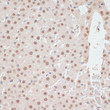Immunohistochemistry analysis of paraffin-embedded Rat liver using Phospho-AMPK Alpha 1-T183/AMPK Alpha 2-T172 Rabbit pAb (STJ11107614) at dilution of 1:100 (40x lens). Microwave antigen retrieval performed with 0. 01M Tris/EDTA Buffer (pH 9. 0) prior to immunohistochemistry staining.