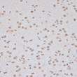 Immunohistochemistry analysis of paraffin-embedded Mouse brain using Phospho-AMPKÎ±1-T183/AMPKÎ±2-T172 Rabbit pAb (STJ11107614) at dilution of 1:100 (40x lens). Microwave antigen retrieval performed with 0. 01M Tris/EDTA Buffer (pH 9. 0) prior to immunohistochemistry staining.
