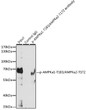 Immunoprecipitation analysis of 200 Mu g extracts of C2C12 cells, using 3 Mu g Phospho-AMPKÎ±1-T183/AMPKÎ±2-T172 pAb (STJ11107614). Western blot was performed from the immunoprecipitate using Phospho-AMPKa1-T183/AMPKa2-T172 pAb (STJ11107614) at a dilution of 1:1000. C2C12 cells were treated by oligomycin (0. 5 uM) at 37C for 30 minutes.