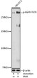 Western blot analysis of lysates from NIH/3T3 cells, using Phospho-EGFR-T678 Rabbit pAb (STJ11107618) at 1:1000 dilution. NIH/3T3 cells were treated by PMA/TPA (200 nM) at 37C for 30 minutes after serum-starvation overnight. <br>Secondary antibody: HRP-conjugated Goat anti-Rabbit IgG (H+L) (STJS000856) at 1:10000 dilution. <br>Lysates/proteins: 25 Mu g per lane. <br>Blocking buffer: 3% nonfat dry milk in TBST. <br>Detection: ECL Enhanced Kit <br>Exposure time: 60s.