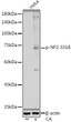 Western blot analysis of lysates from HeLa cells, using Phospho-NF2-S518 Rabbit pAb (STJ11107692) at 1:1000 dilution. HeLa cells were treated by Calyculin A (100 nM) at 37 °C for 30 minutes after serum-starvation overnight. <br/>Secondary antibody: HRP-conjugated Goat anti-Rabbit IgG (H+L) (STJS000856) at 1:10000 dilution. <br/>Lysates/proteins: 25 Mu g per lane. <br/>Blocking buffer: 3% nonfat dry milk in TBST. <br/>Detection: ECL Basic Kit <br/>Exposure time: 10s.